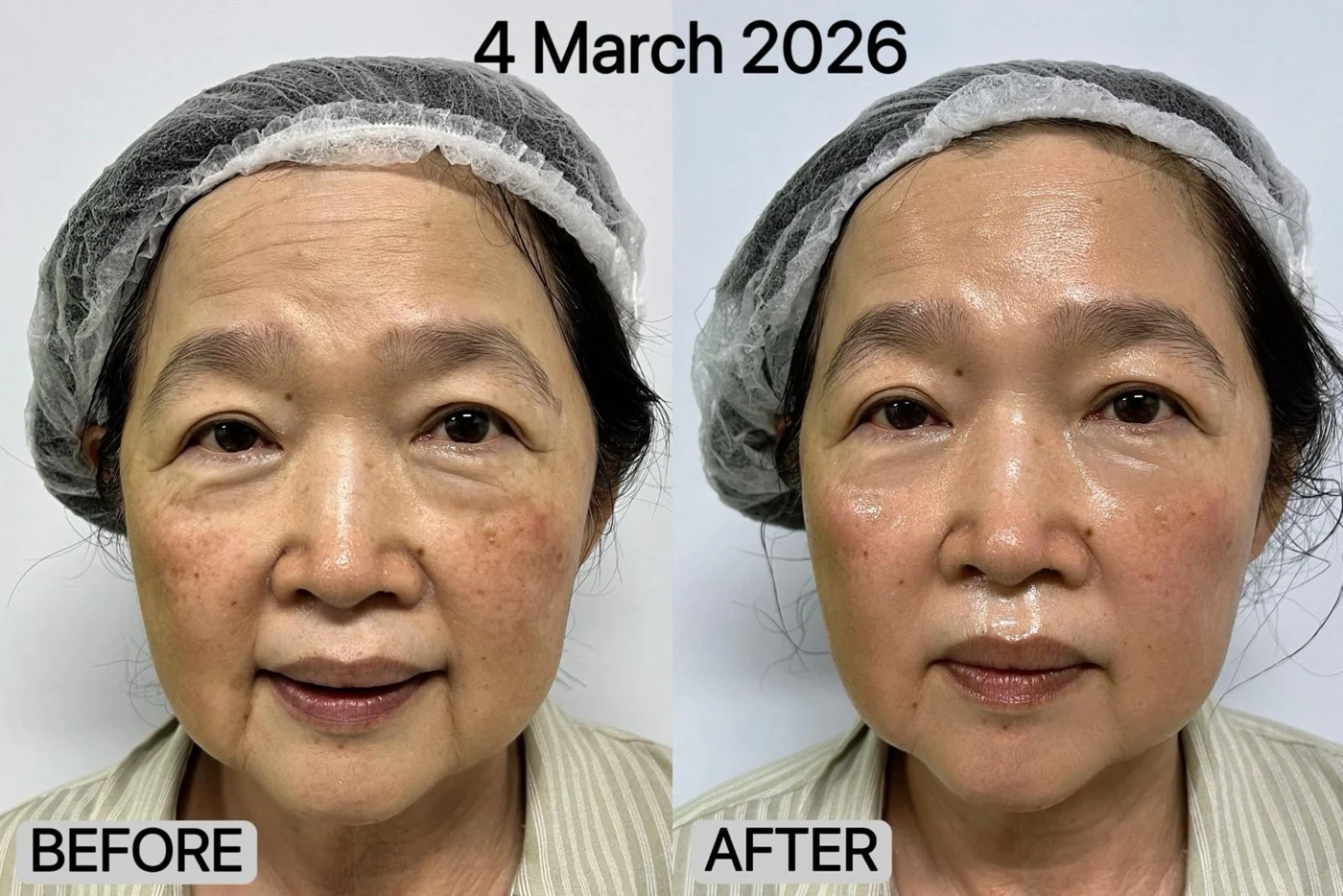Facial care: original treatment comparison, with its original labels