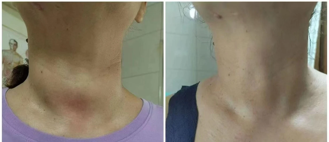 Neck care: original treatment comparison, with its original labels