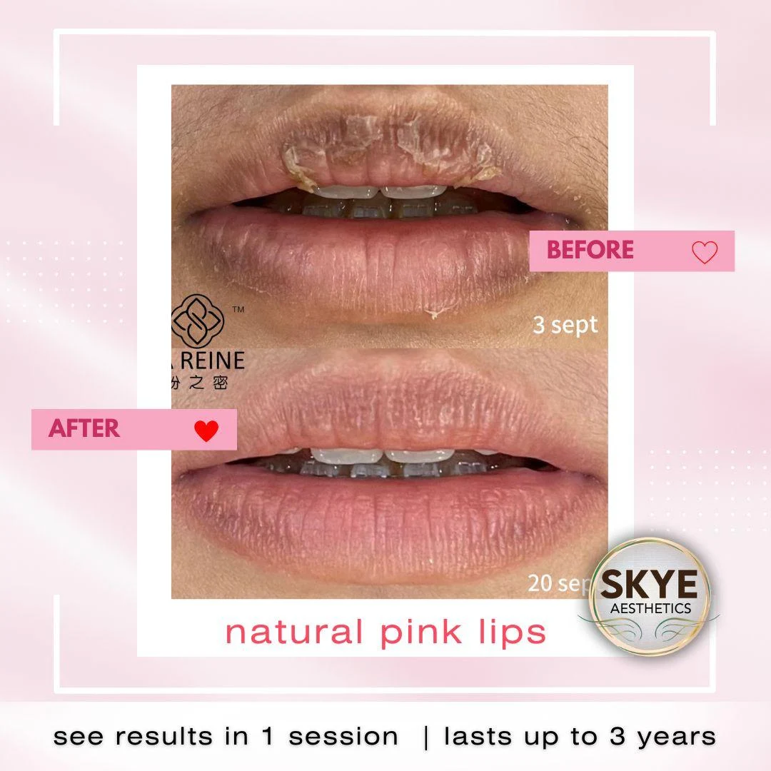 Lip care: original treatment comparison, with its original labels
