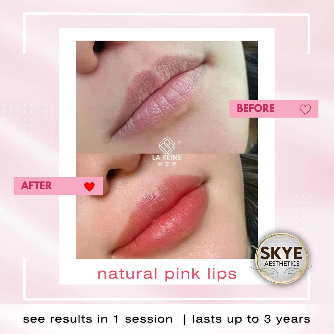 Lip care: original treatment comparison, with its original labels