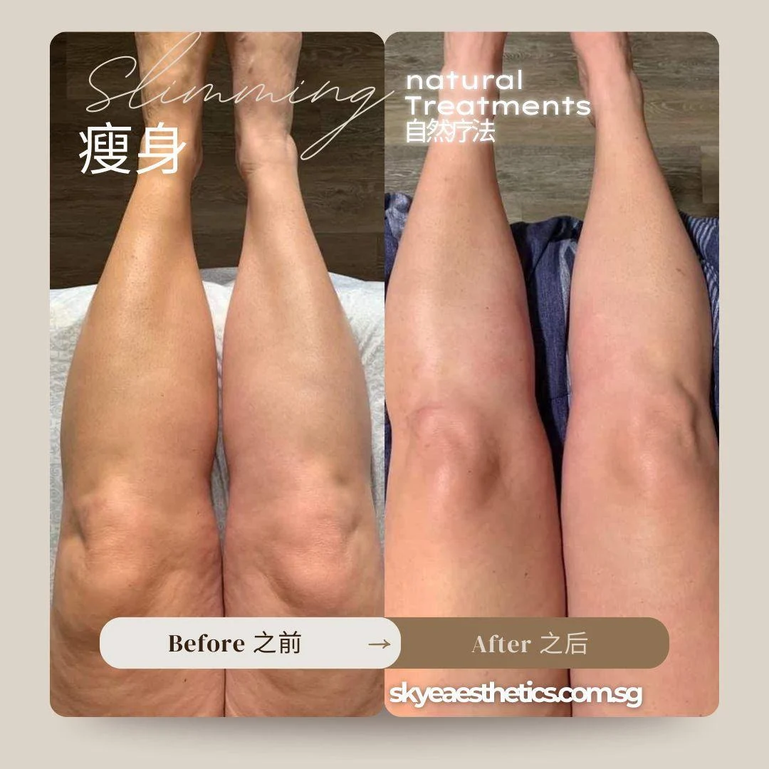 Leg care: original treatment comparison, with its original labels