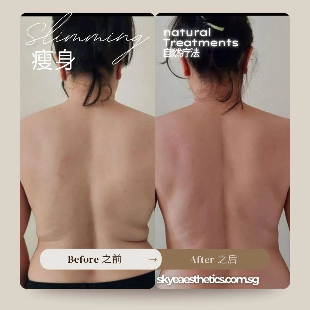 Back care: original treatment comparison, with its original labels