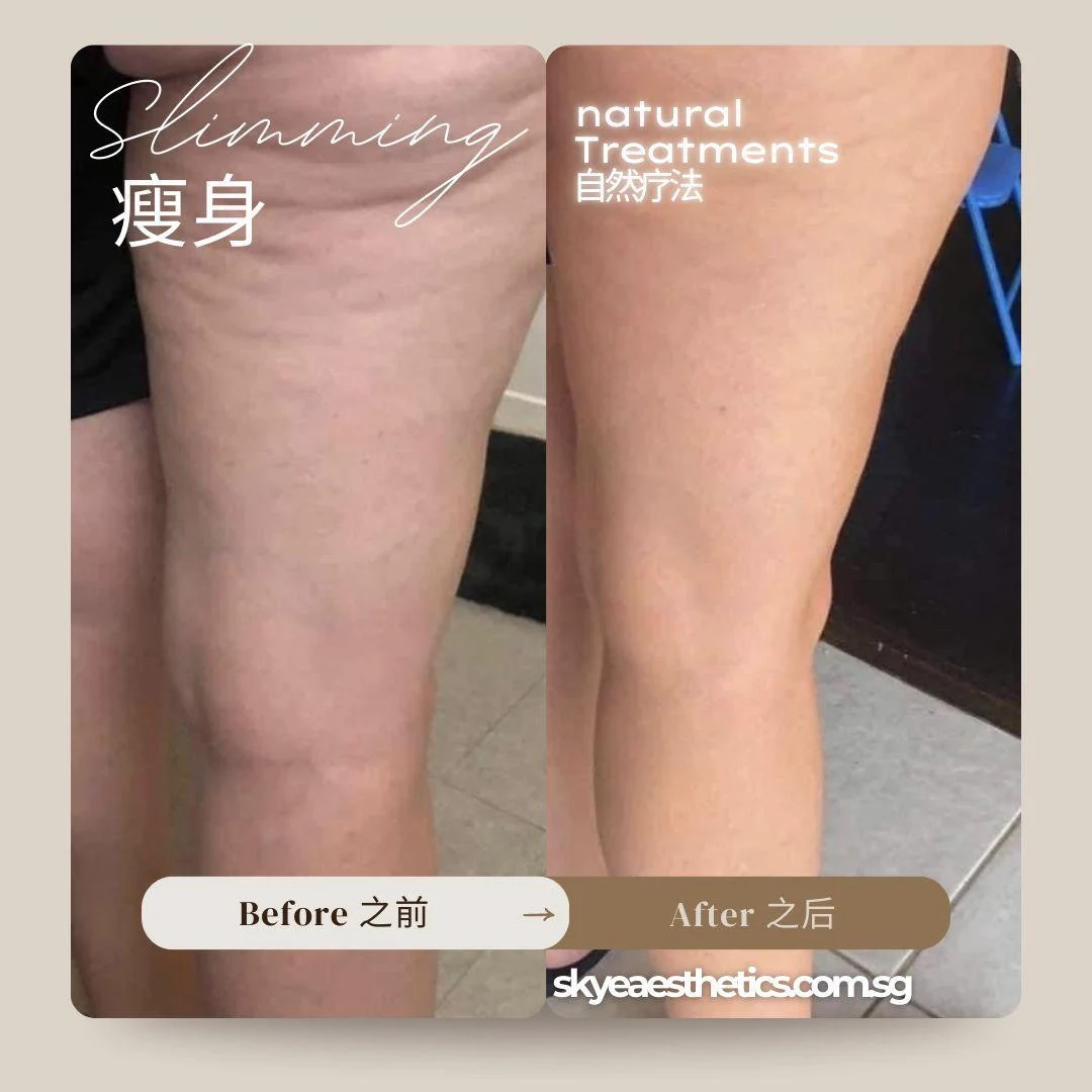Leg care: original treatment comparison, with its original labels