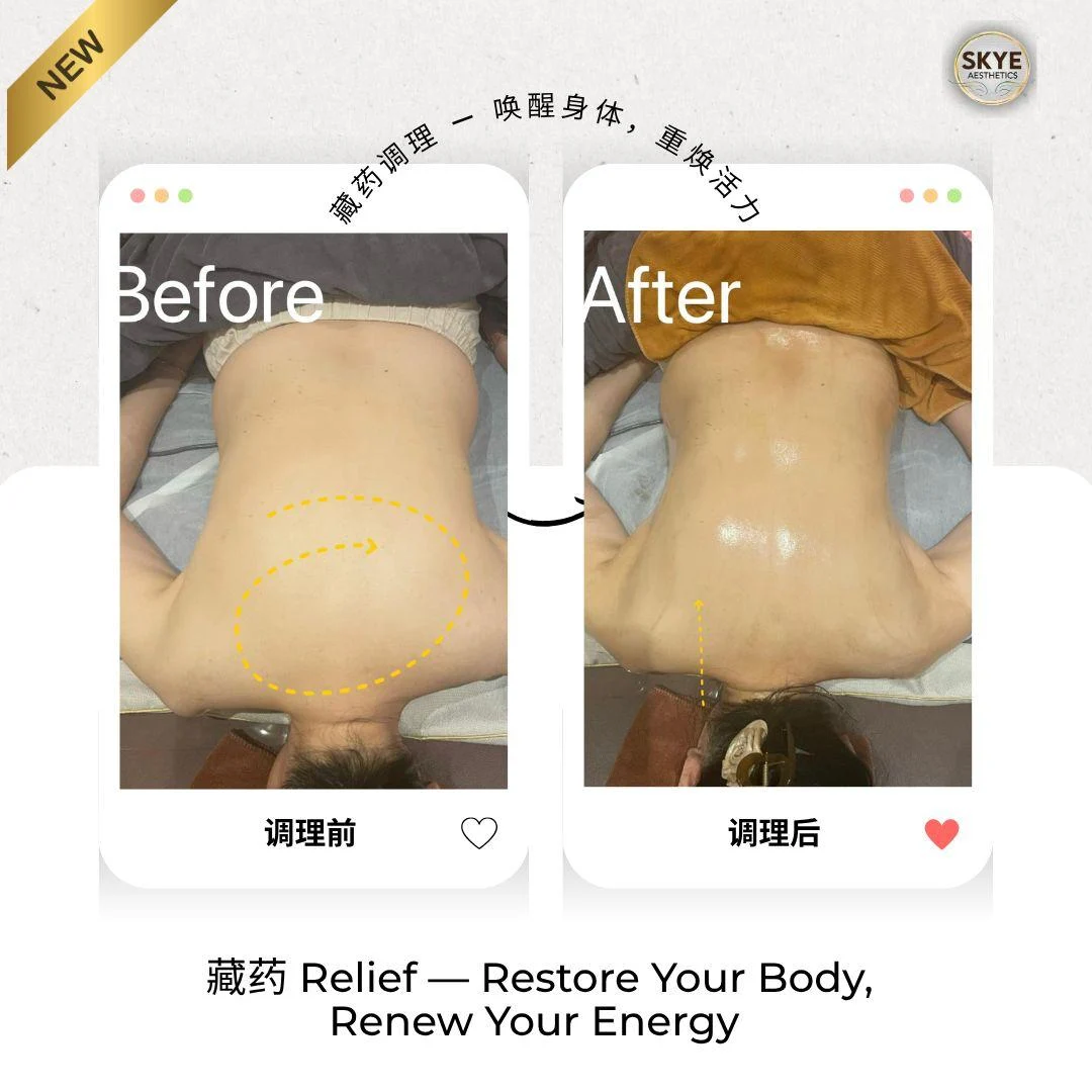 Shoulder & back care: original treatment comparison, with its original labels