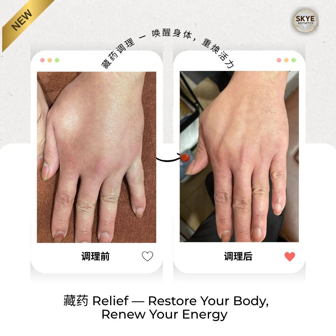 Hand care: original treatment comparison, with its original labels