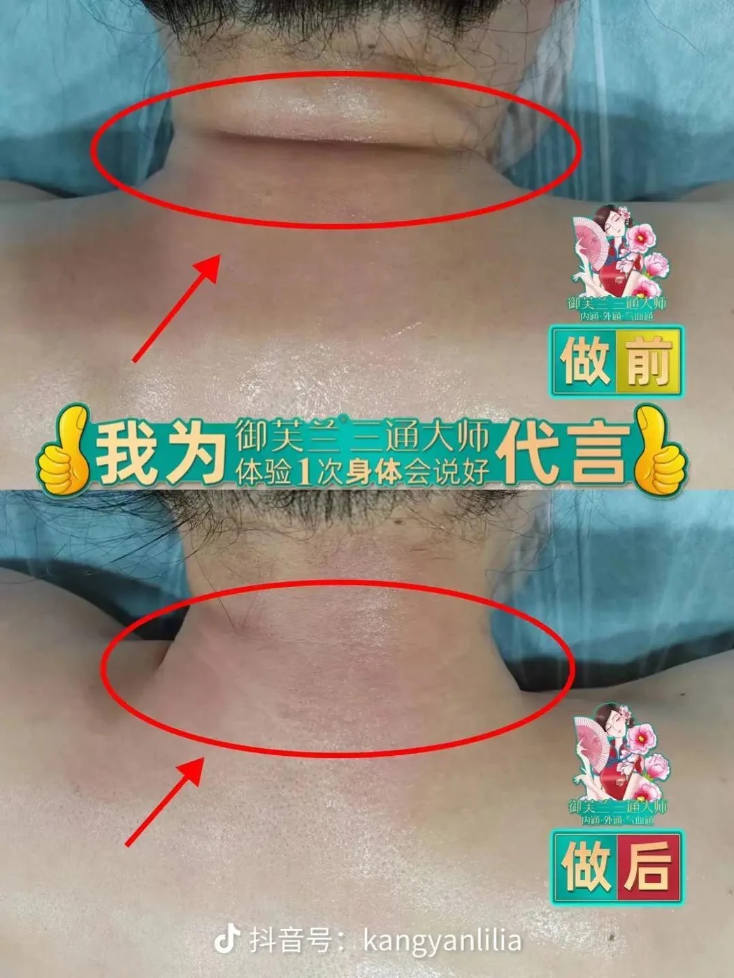 Neck & shoulder care: original treatment comparison, with its original labels